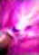 Nova Cast Strengthener